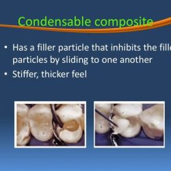 Composite resin based three seminar dental 2010 posterior ppt powerpoint presentation primary effective permanent november 2009